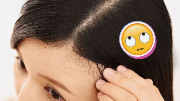 Banishing Forehead ‘Fuzz’: A Guide to Taming Those Pesky Baby Hairs
