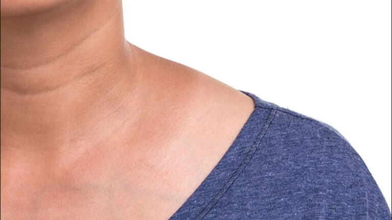 Revitalising Your Neck: Banishing Dark Patches with Home Remedies